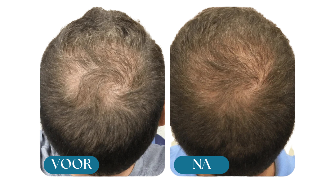 Morge™ Shampooing Réparation & Croissance