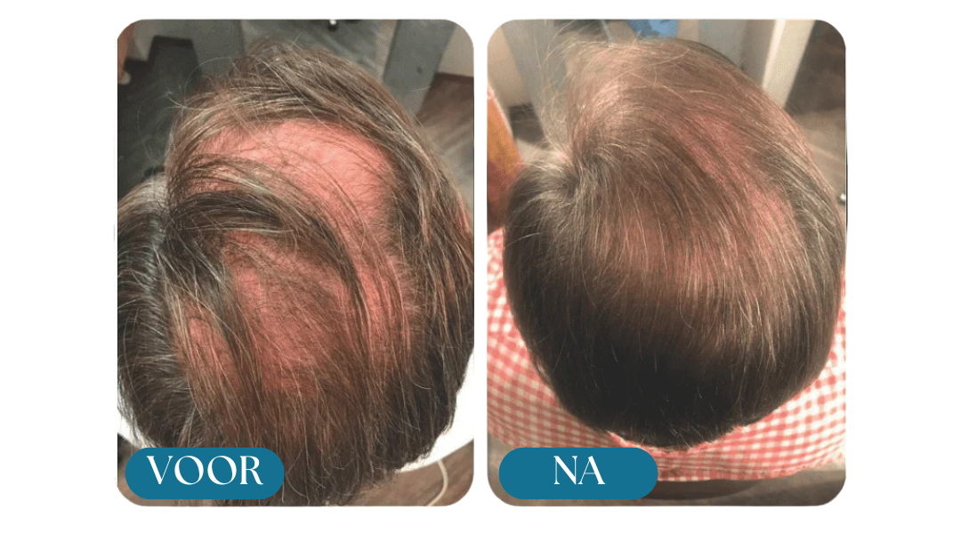 Morge™ Shampooing Réparation & Croissance