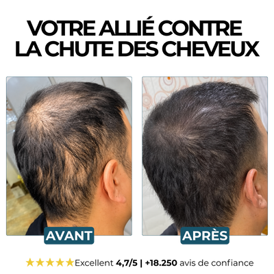 Morge™ Shampooing Réparation & Croissance