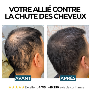 Morge™ Shampooing Réparation & Croissance
