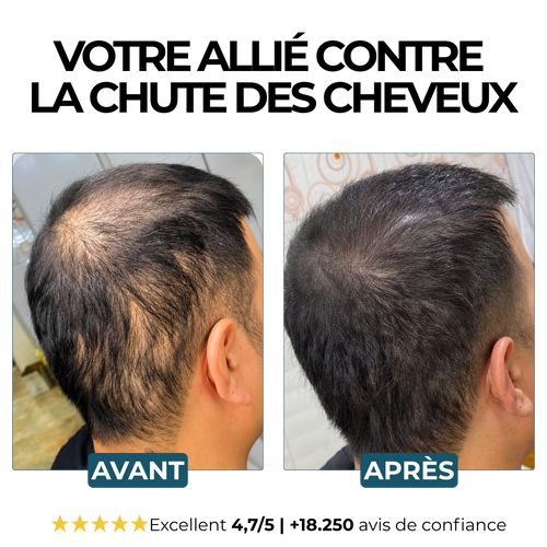 Morge™ Shampooing Réparation & Croissance